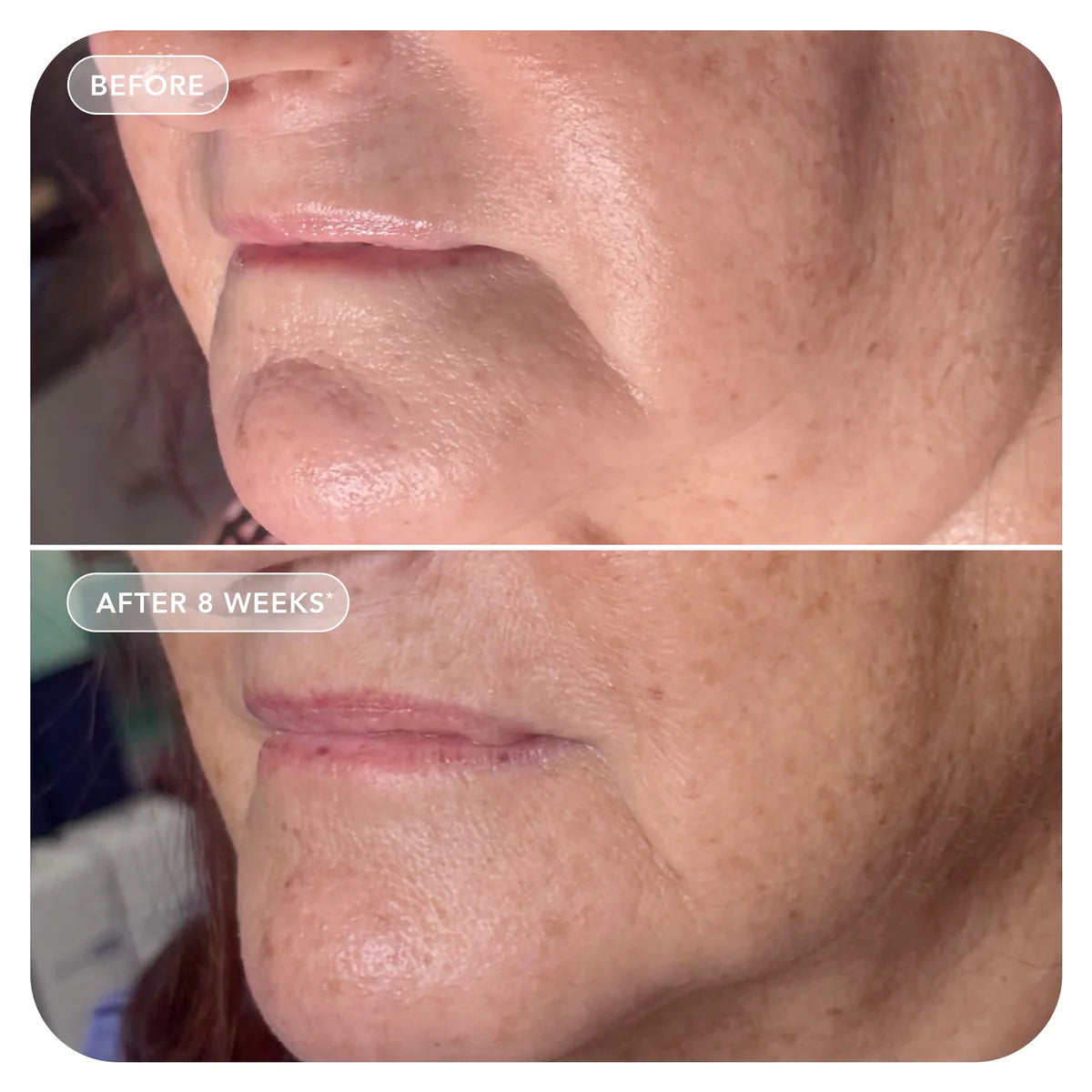 VOL.U.LIFT Cream